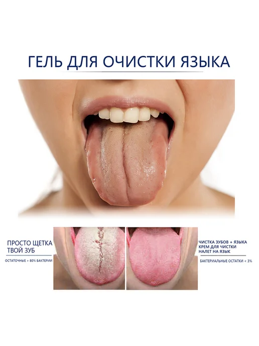 eelhoe Очищающий гель для языка устраняет неприятный запах изо рта, синий, фото 5