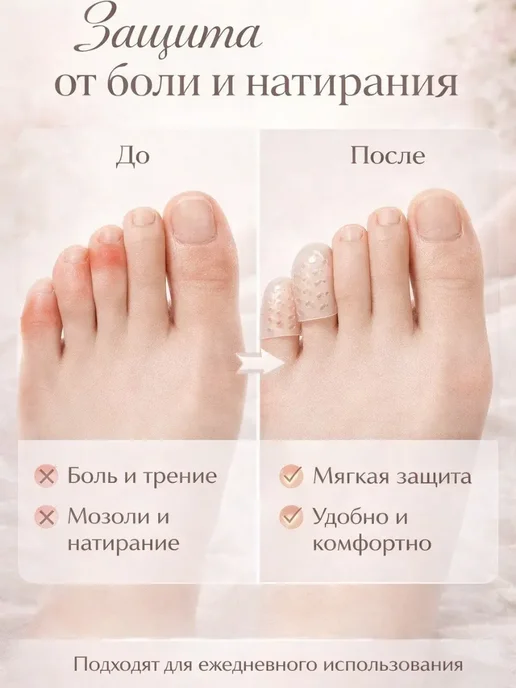 Khadijat Напальчники для ног защита от натирания и мозолей колпачки, вариант, фото 3