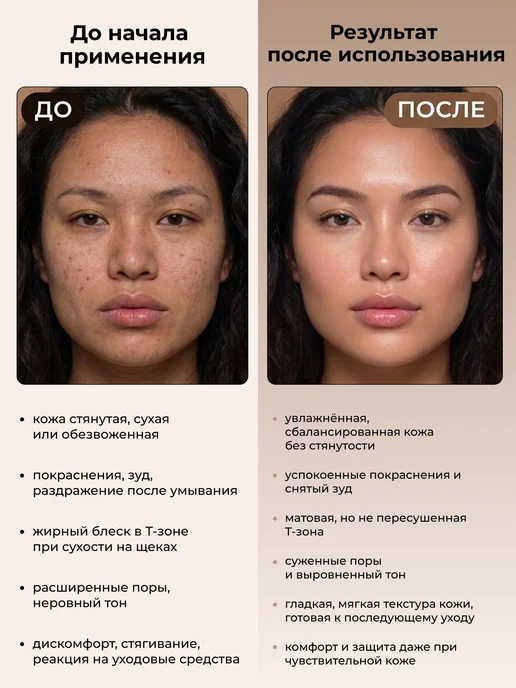 ANNA LOTAN Лосьон для проблемной кожи лица Clear Propolis Lotion 200 мл, 200 мл, фото 3