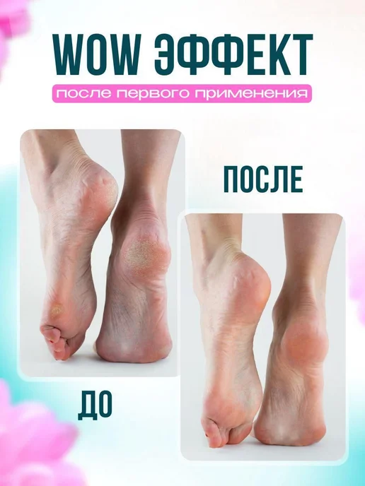 Пемза для пяток лазерная нано-пилка, вариант