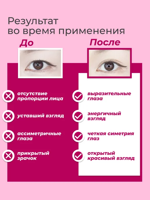 Smooth Skins Лифтинг полоски для коррекции век (600 шт), 600 шт, фото 2
