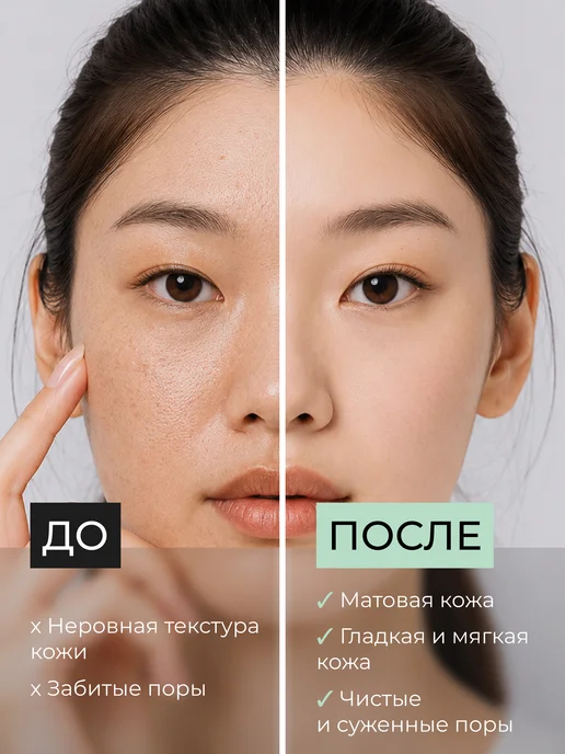 Celimax Отшелушивающие тонер-пэды от воспалений, 10шт, 10 шт, фото 2