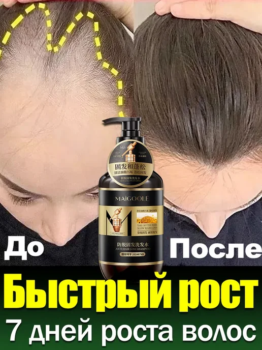 Шампунь для роста волос от выпадения, 400 мл, фото 2