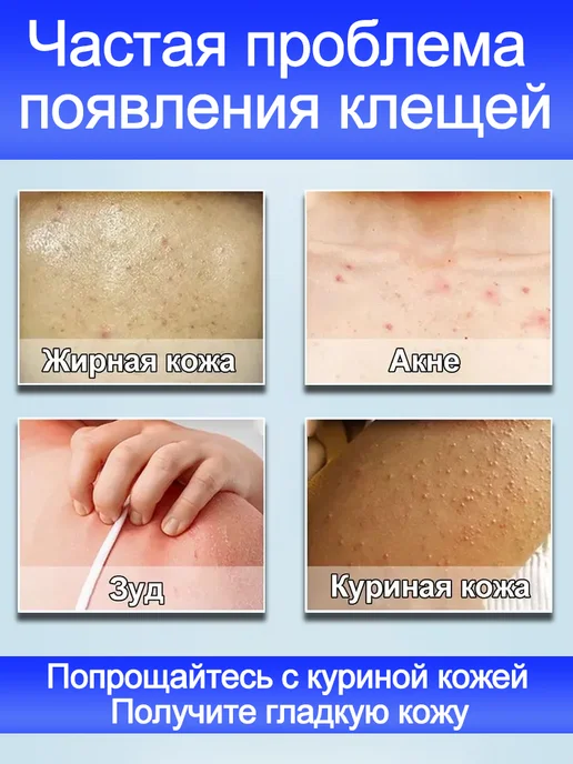 IUALLURE Гель для душа против акне и клещей,300 мл, 300 мл, фото 3