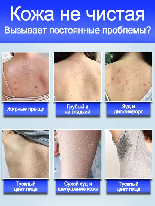 IUALLURE Гель для душа против акне и клещей,300 мл, 300 мл, фото 4