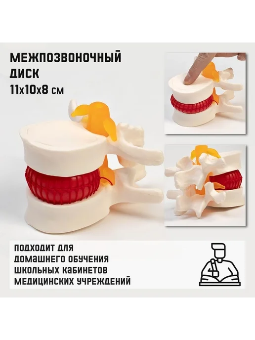 Образец анатомического макета позвоночника, вариант, фото 4