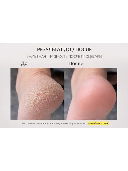izabrand Жидкая пемза для педикюра и маникюра средство от трещин, вариант, фото 2