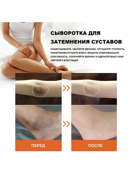 eelhoe Натуральное увлажняющее масло для лица питает от пигментации, вариант, фото 7