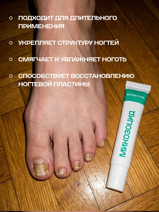 МИКОЗОЦИД Крем гель от грибка ногтей на ногах, 10 мл, фото 7