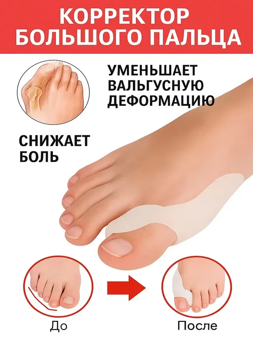 Фиксатор большого пальца ноги 2шт вальгус, 2 шт, фото 2