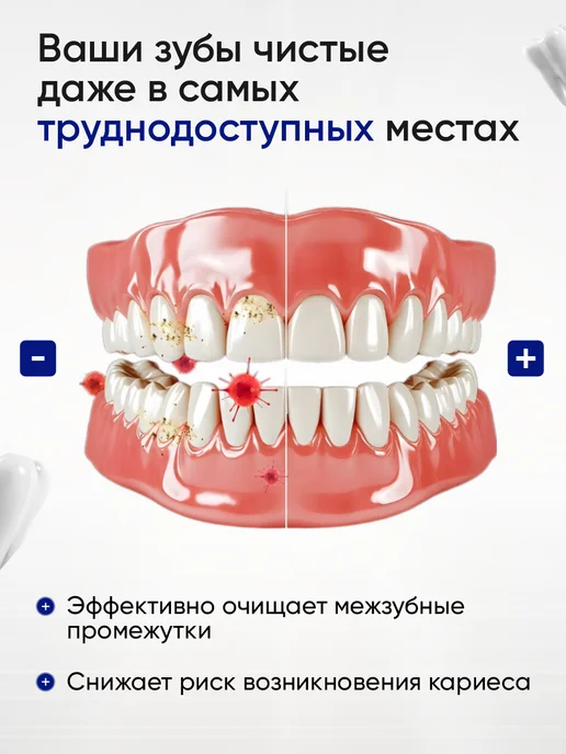 G&OUnity Межзубные ершики для брекетов 1-1.2мм - 20шт, 20 шт, фото 7
