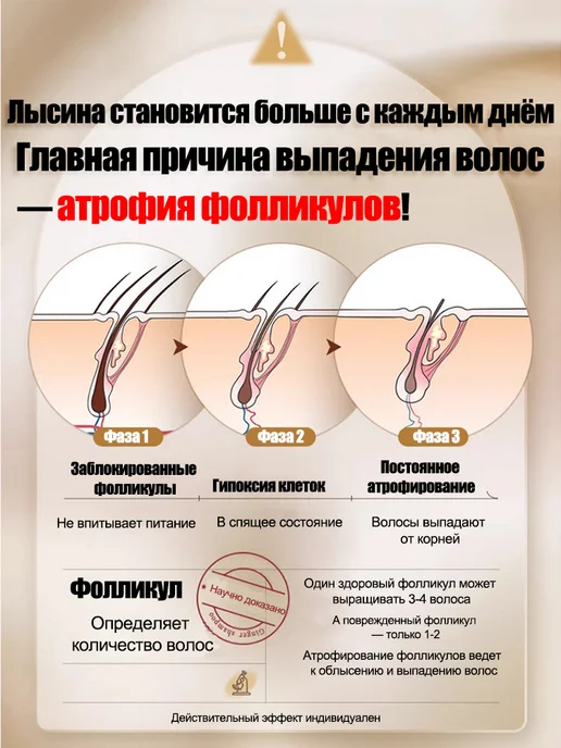 LYDIMOON Спрей для роста волос от выпадения, вариант, фото 7